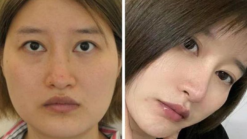 揭秘女性高端皮肤管理：收费背后的秘密
