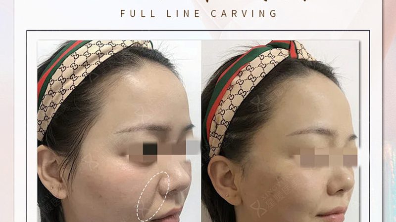 成都整形医院收费标准揭秘：如何理性选择