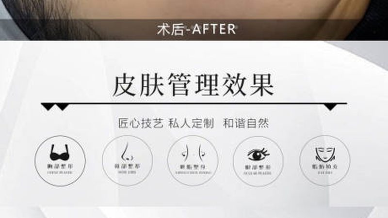 腋下激光脱毛后毛发变粗，是为何？揭秘原因及应对策略**