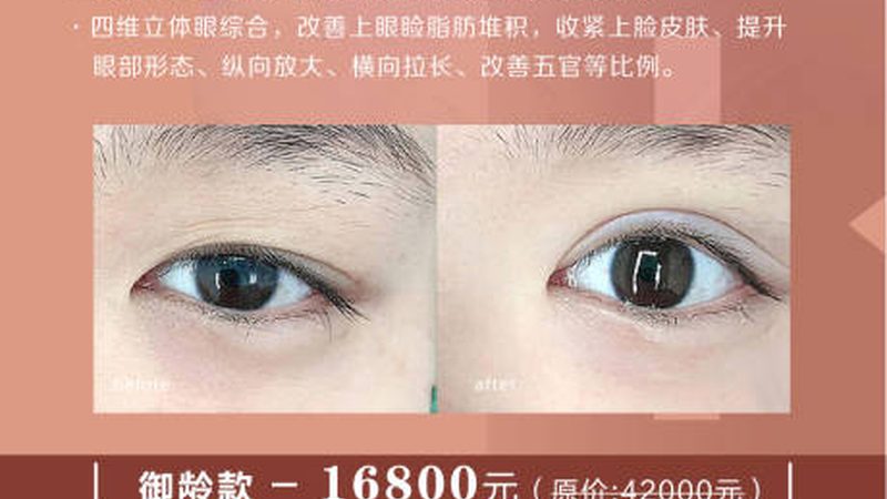 激光脱毛，2025年价格解析与选择要点