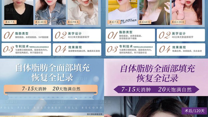 激光脱毛可以永久去除吗