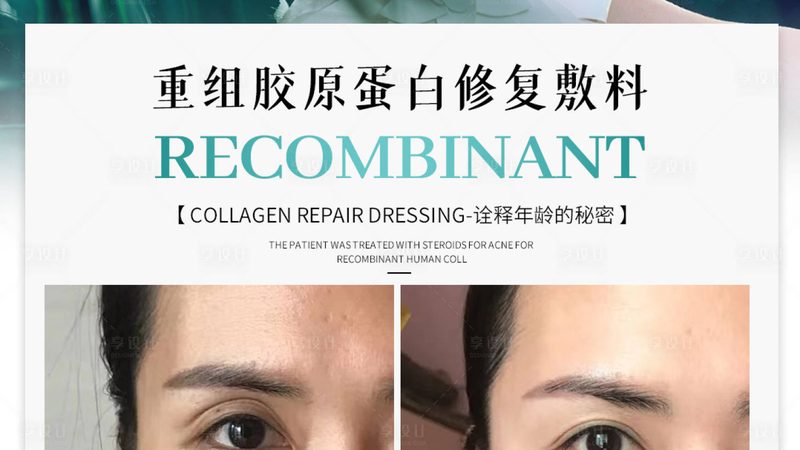 揭秘医疗超声炮：型号间的奥秘与差异