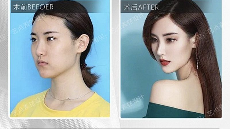 皮肤管理中心产品加盟，先看清这五道门槛