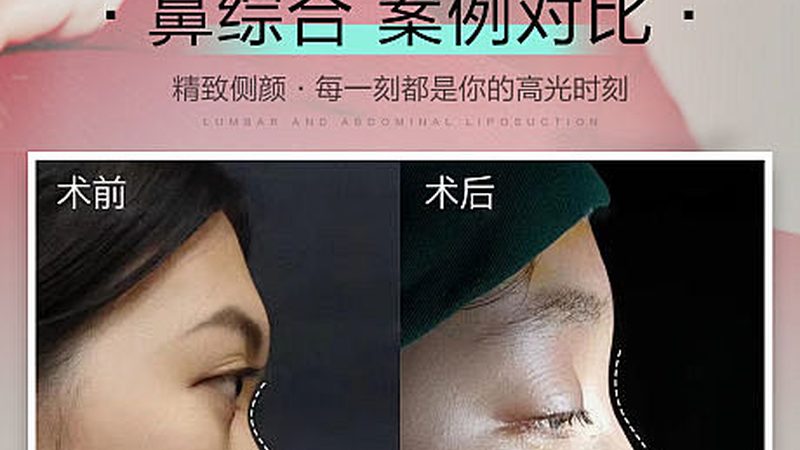 双眼皮手术风险揭秘：真实案例背后的真相