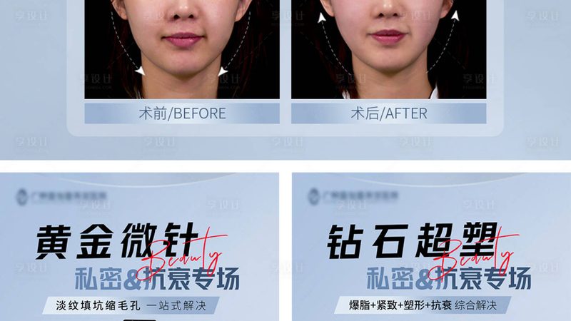 北京埋线提升手术：揭秘提升效果与安全选择