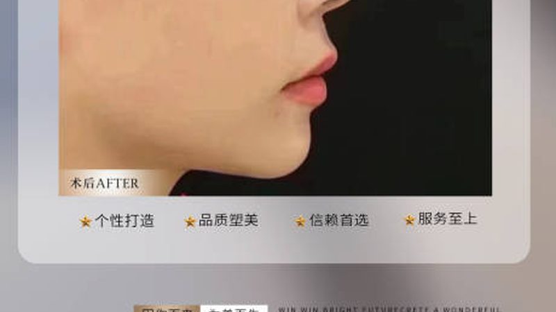医美线材耗材：揭秘批发价格的背后逻辑