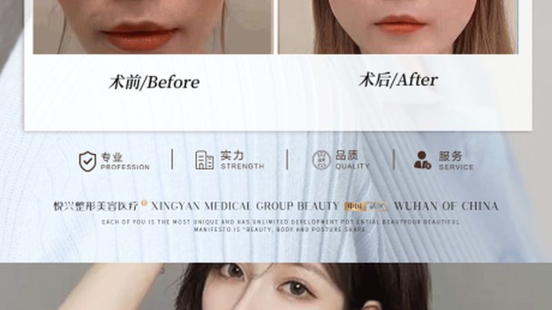 术后修复第一步，选对面膜比药膏更重要