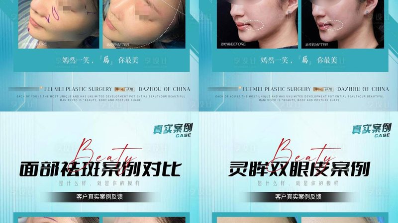 热玛吉2025：揭秘热玛吉价格背后的选购秘诀