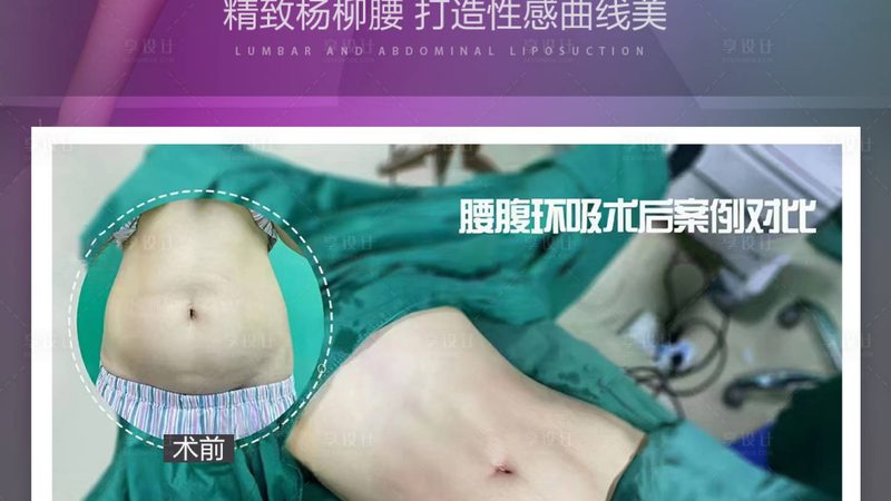 以下为部分肉毒素品牌排名，仅供参考：