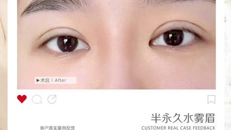 超声炮：揭秘其工作原理与价格构成
