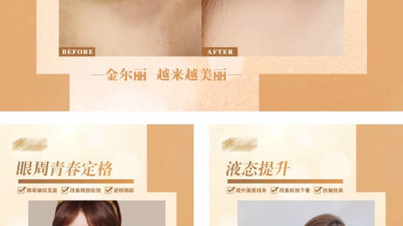 成都激光脱毛前需要做什么准备