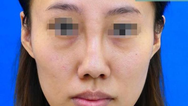 小标题：了解禁忌，安全塑美